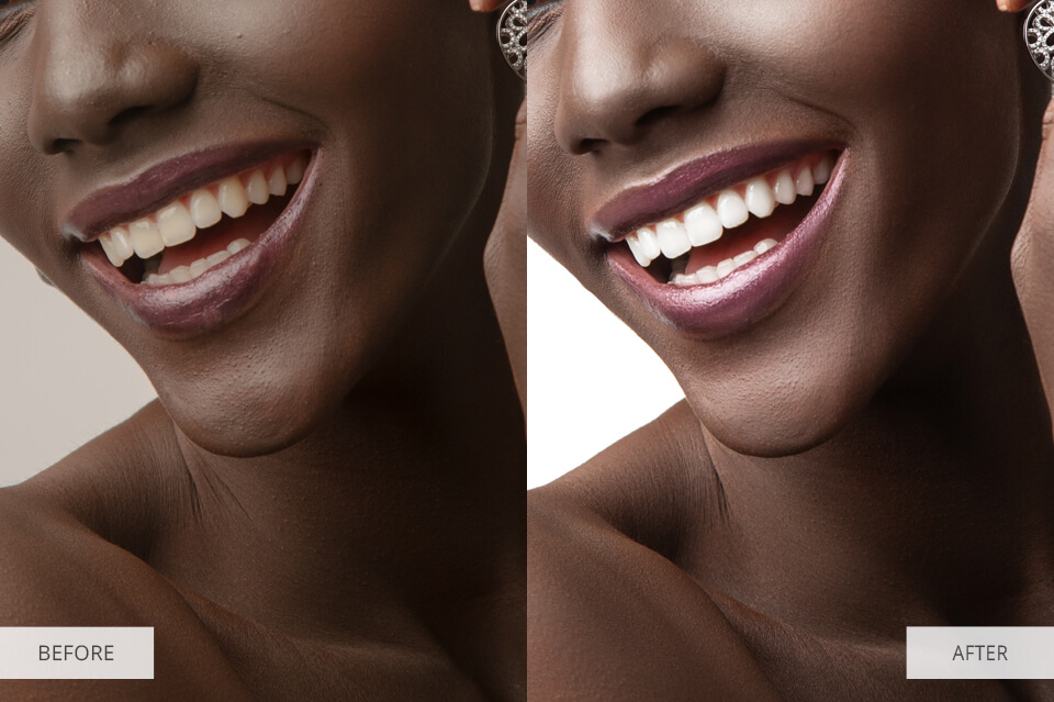 Portrait teeth whitening