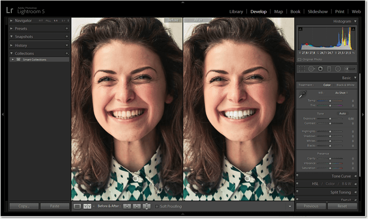 straighten teeth with photopad image editor