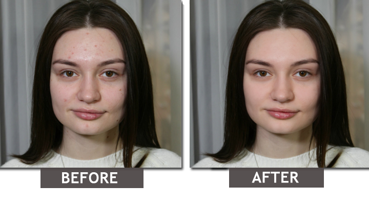 best free photo editing software to remove blemishes